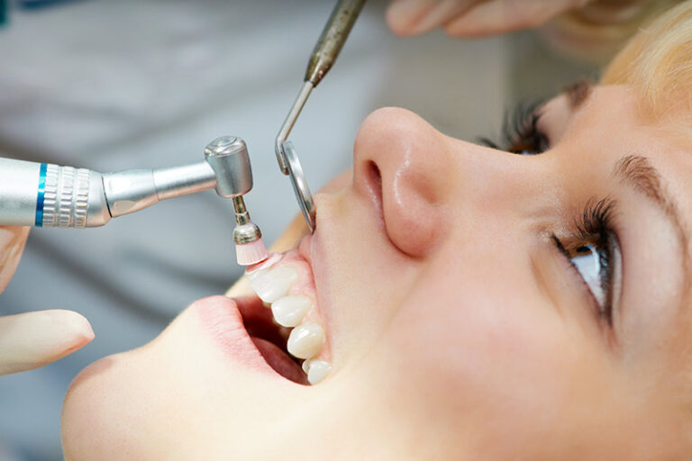 Refreshing Your Oral Health and Wellness Through Oral Prophylaxis 